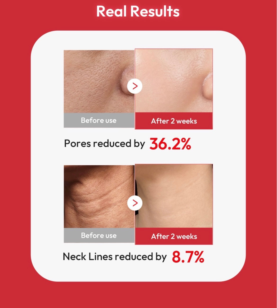 Medicube EGF NAD Firming Serum 30ml